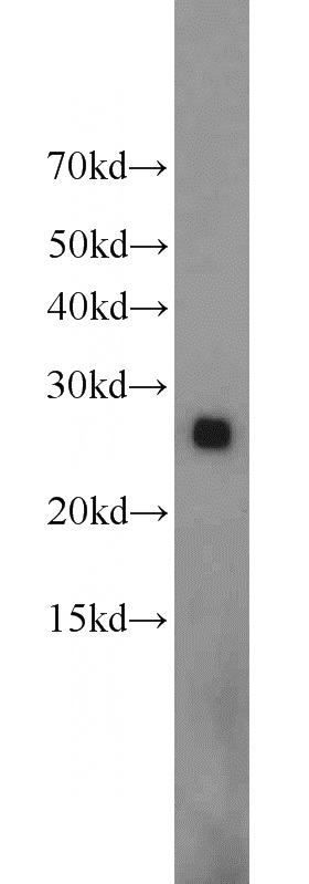 mouse liver tissue were subjected to SDS PAGE followed by western blot with Catalog No:113050(ND1 antibody) at dilution of 1:1000