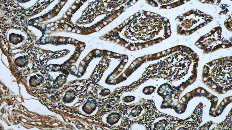 Immunohistochemistry of paraffin-embedded human small intestine tissue slide using Catalog No:117196(BMP2 Antibody) at dilution of 1:50 (under 10x lens)