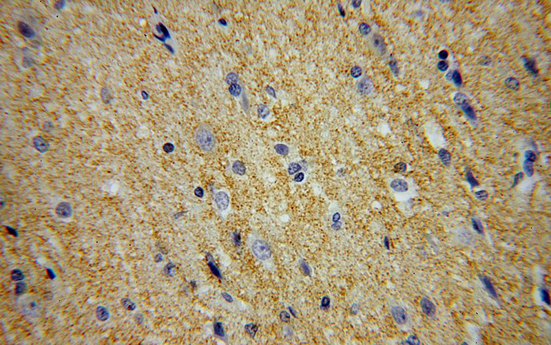 Immunohistochemical of paraffin-embedded human brain using Catalog No:112466(MANBAL antibody) at dilution of 1:100 (under 40x lens)