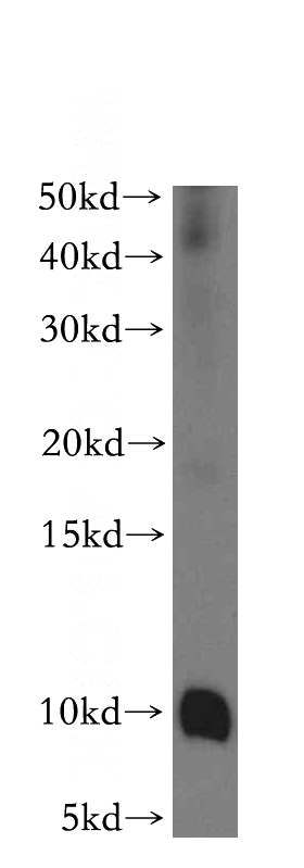 mouse pancreas tissue were subjected to SDS PAGE followed by western blot with Catalog No:109216(CHCHD7 antibody) at dilution of 1:500
