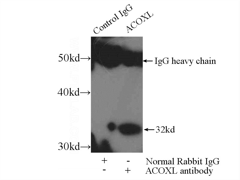 IP Result of anti-ACOXL (IP:Catalog No:107687, 3ug; Detection:Catalog No:107687 1:300) with K-562 cells lysate 2000ug.