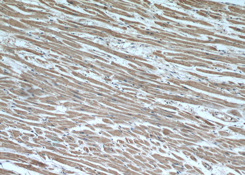 Immunohistochemical of paraffin-embedded human heart using Catalog No:115078(SEC23IP antibody) at dilution of 1:50 (under 10x lens)