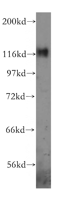 A431 cells were subjected to SDS PAGE followed by western blot with Catalog No:113534(BCAR1 antibody) at dilution of 1:800