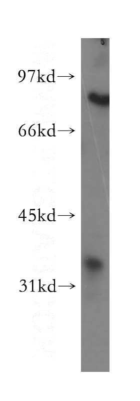 human liver tissue were subjected to SDS PAGE followed by western blot with Catalog No:113864(PHYH antibody) at dilution of 1:500
