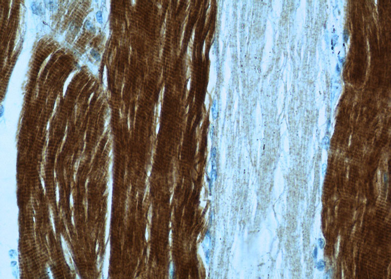 Immunohistochemistry of paraffin-embedded human skeletal muscle slide using Catalog No:116153(TNNI2 Antibody) at dilution of 1:50