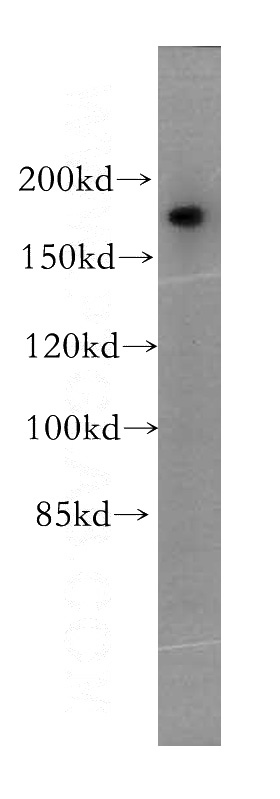 A375 cells were subjected to SDS PAGE followed by western blot with Catalog No:114320(PTPN23 antibody) at dilution of 1:500