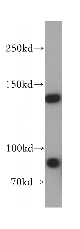 mouse testis tissue were subjected to SDS PAGE followed by western blot with Catalog No:112465(MAN2B2 antibody) at dilution of 1:300