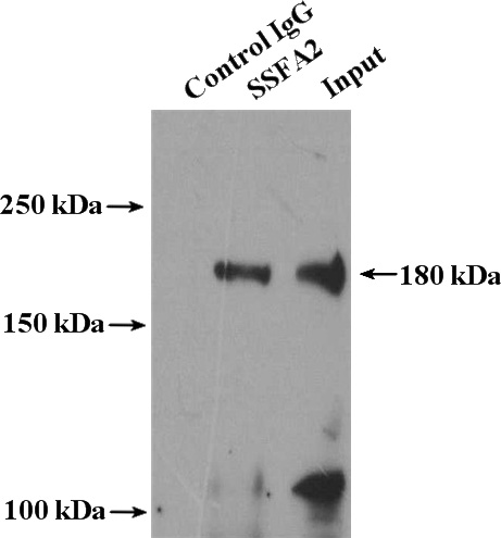 IP Result of anti-KRAP, SSFA2 (IP:Catalog No:112118, 4ug; Detection:Catalog No:112118 1:500) with mouse testis tissue lysate 4000ug.