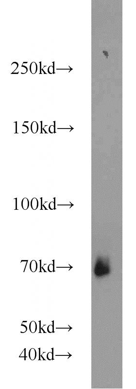 K-562 cells were subjected to SDS PAGE followed by western blot with Catalog No:109595(CSGALNACT2 antibody) at dilution of 1:800