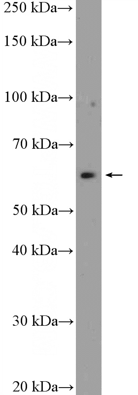 mouse brain tissue were subjected to SDS PAGE followed by western blot with Catalog No:115631(ST7 Antibody) at dilution of 1:2000