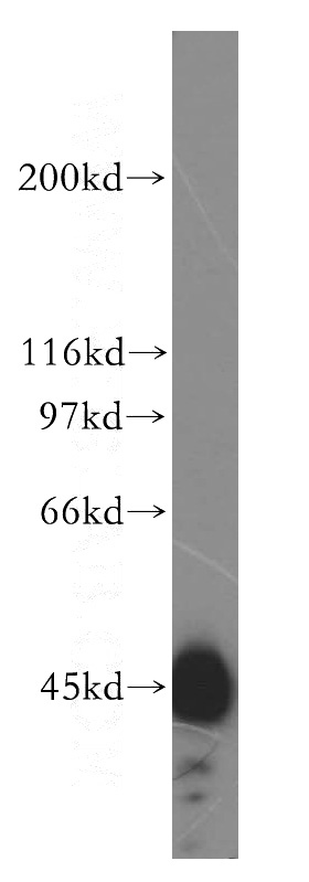 HEK-293 cells were subjected to SDS PAGE followed by western blot with Catalog No:111555(HSDL2 antibody) at dilution of 1:500