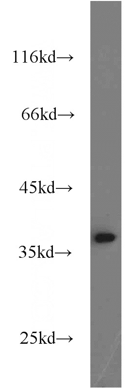 Jurkat cells were subjected to SDS PAGE followed by western blot with Catalog No:110994(GNB1 antibody) at dilution of 1:2000