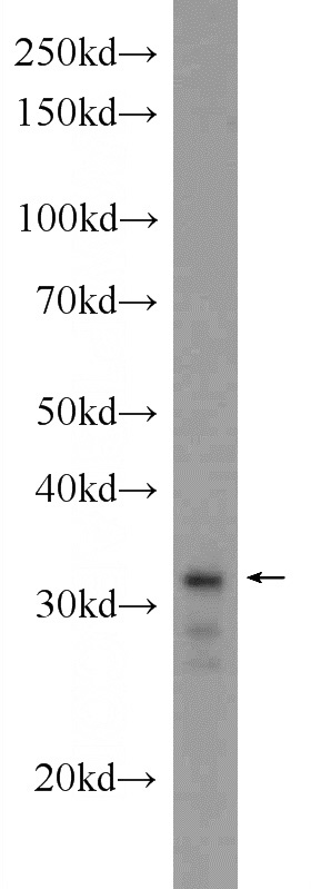 HEK-293 cells were subjected to SDS PAGE followed by western blot with Catalog No:116982(XBP1 Antibody) at dilution of 1:300