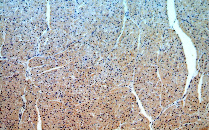 Immunohistochemical of paraffin-embedded human heart using Catalog No:114570(RCAN1 antibody) at dilution of 1:100 (under 10x lens)