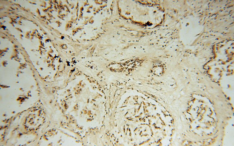 Immunohistochemical of paraffin-embedded human prostate using Catalog No:115721(STK36 antibody) at dilution of 1:50 (under 10x lens)