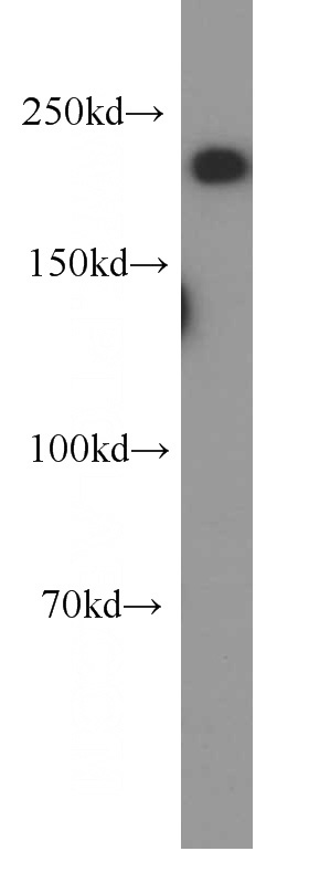 mouse brain tissue were subjected to SDS PAGE followed by western blot with Catalog No:112930(MYH10-Specific antibody) at dilution of 1:1000