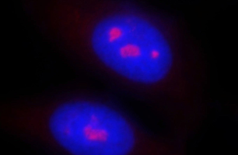 Immunofluorescent analysis of HepG2 cells, using SRM antibody Catalog No:115562 at 1:25 dilution and Rhodamine-labeled goat anti-rabbit IgG (red). Blue pseudocolor = DAPI (fluorescent DNA dye).