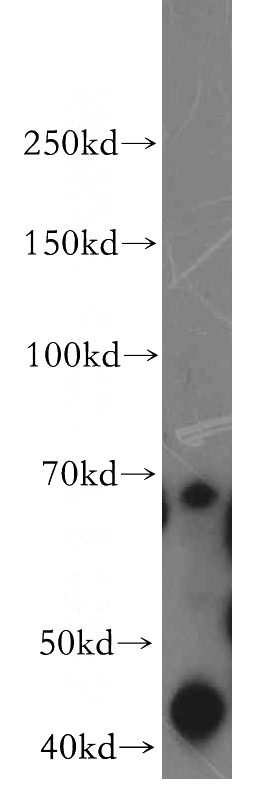 Jurkat cells were subjected to SDS PAGE followed by western blot with Catalog No:114191(PRICKLE3 antibody) at dilution of 1:500