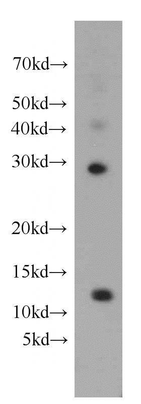 HepG2 cells were subjected to SDS PAGE followed by western blot with Catalog No:109768(DDA1 antibody) at dilution of 1:100