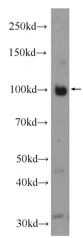mouse heart tissue were subjected to SDS PAGE followed by western blot with Catalog No:110380(ESF1 Antibody) at dilution of 1:2000