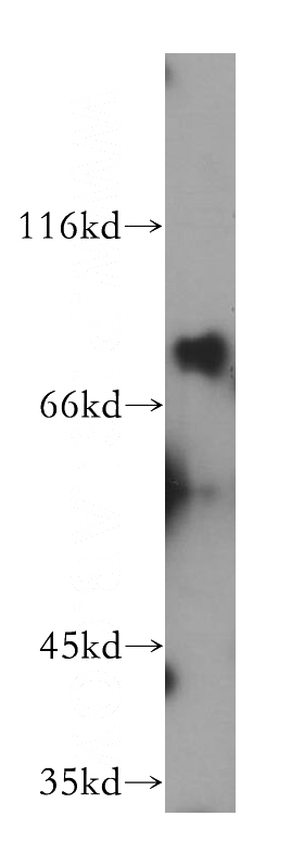 HEK-293 cells were subjected to SDS PAGE followed by western blot with Catalog No:110128(DYM antibody) at dilution of 1:600