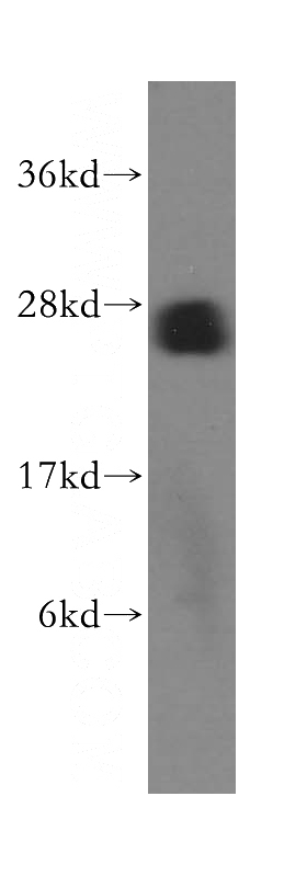 human brain tissue were subjected to SDS PAGE followed by western blot with Catalog No:117208(BNIP1 antibody) at dilution of 1:500