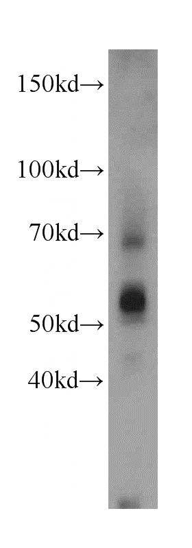 mouse ovary tissue were subjected to SDS PAGE followed by western blot with Catalog No:115057(SAMM50 antibody) at dilution of 1:400