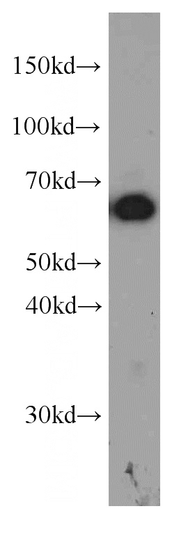 PC-3 cells were subjected to SDS PAGE followed by western blot with Catalog No:107444(P4HA1 antibody) at dilution of 1:1000