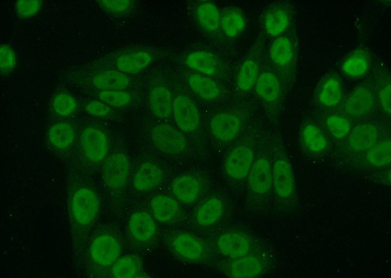 Immunofluorescent analysis of (10% Formaldehyde) fixed HeLa cells using Catalog No:108282(ATF1 Antibody) at dilution of 1:50 and Alexa Fluor 488-congugated AffiniPure Goat Anti-Rabbit IgG(H+L)