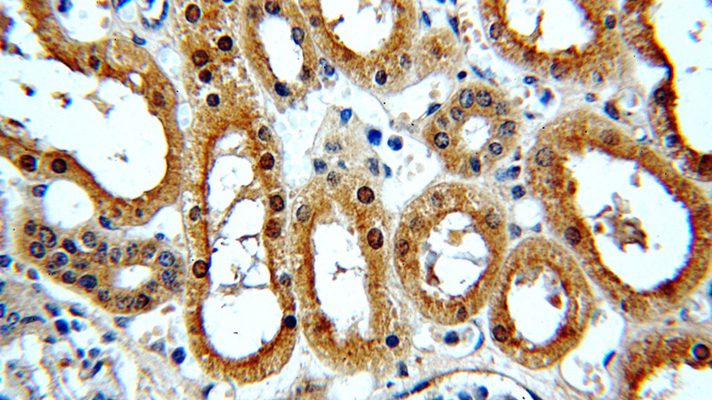 Immunohistochemical of paraffin-embedded human kidney using Catalog No:113247(NME2 antibody) at dilution of 1:50 (under 40x lens)