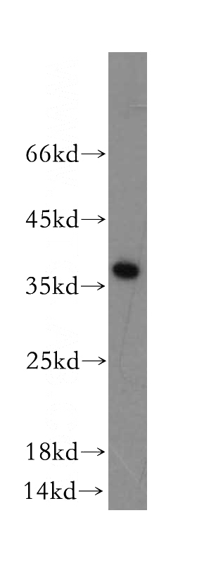human heart tissue were subjected to SDS PAGE followed by western blot with Catalog No:108320(ATPAF1 antibody) at dilution of 1:500