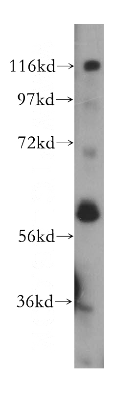 human heart tissue were subjected to SDS PAGE followed by western blot with Catalog No:113769(PFKFB2 antibody) at dilution of 1:500