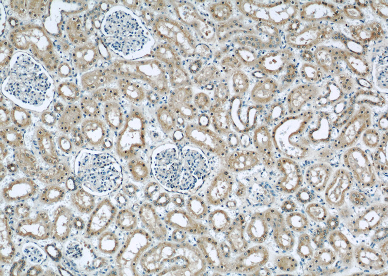 Immunohistochemical of paraffin-embedded human kidney using Catalog No:110047(DocK8 antibody) at dilution of 1:50 (under 10x lens)