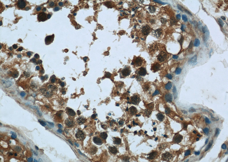 Immunohistochemistry of paraffin-embedded human testis tissue slide using Catalog No:108784(C6orf211 Antibody) at dilution of 1:50 (under 40x lens)