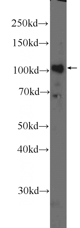 SMMC-7721 cells were subjected to SDS PAGE followed by western blot with Catalog No:109780(DDX10 Antibody) at dilution of 1:300