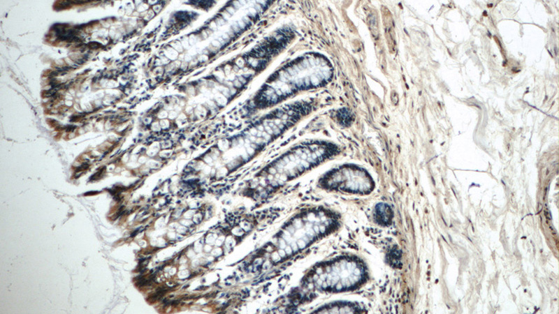 Immunohistochemistry of paraffin-embedded human colon tissue slide using Catalog No:113438(OSGEPL1 Antibody) at dilution of 1:50 (under 10x lens)