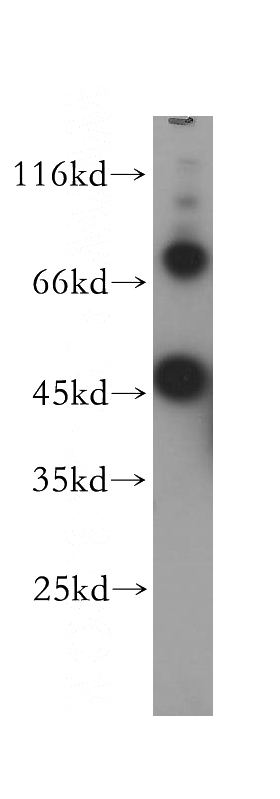 HEK-293 cells were subjected to SDS PAGE followed by western blot with Catalog No:109295(CHST14 antibody) at dilution of 1:600