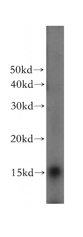 HeLa cells were subjected to SDS PAGE followed by western blot with Catalog No:114878(RPL23 antibody) at dilution of 1:200