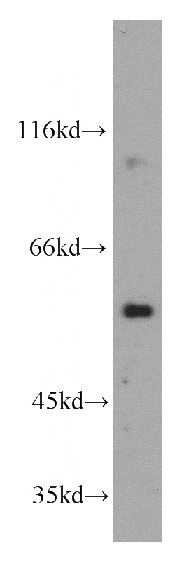 mouse brain tissue were subjected to SDS PAGE followed by western blot with Catalog No:109520(CPNE9-Specific antibody) at dilution of 1:200