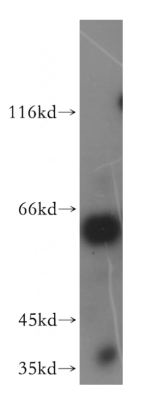 K-562 cells were subjected to SDS PAGE followed by western blot with Catalog No:112112(KPNA1 antibody) at dilution of 1:500