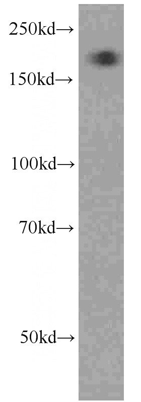 HepG2 cells were subjected to SDS PAGE followed by western blot with Catalog No:107581(A2M antibody) at dilution of 1:1000