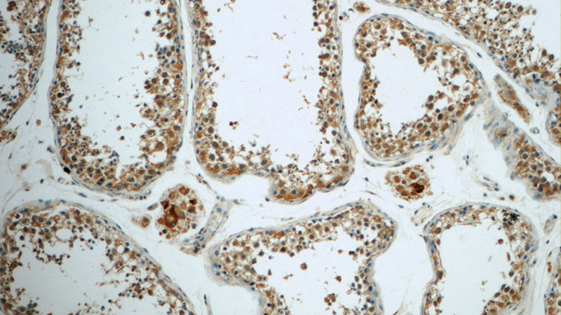 Immunohistochemistry of paraffin-embedded human testis tissue slide using Catalog No:114914(RPS6KL1 Antibody) at dilution of 1:50 (under 10x lens)