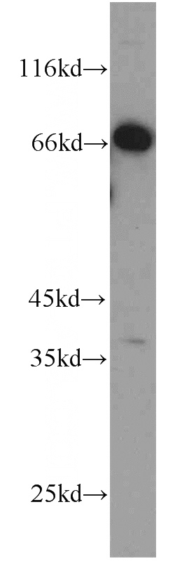 PC-3 cells were subjected to SDS PAGE followed by western blot with Catalog No:108633(C1orf116 antibody) at dilution of 1:800
