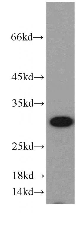 A431 cells were subjected to SDS PAGE followed by western blot with Catalog No:110907(GCLM antibody) at dilution of 1:500