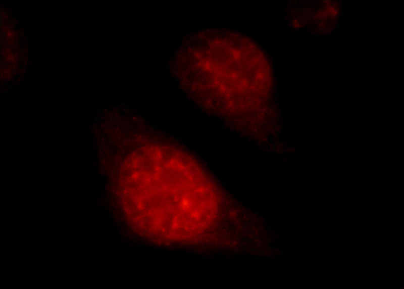 Immunofluorescent analysis of HepG2 cells, using SART1 antibody Catalog No:114972 at 1:50 dilution and Rhodamine-labeled goat anti-rabbit IgG (red).