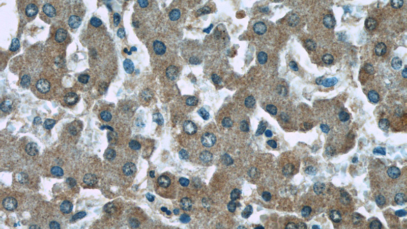 Immunohistochemistry of paraffin-embedded human liver tissue slide using Catalog No:107212(FGG Antibody) at dilution of 1:50 (under 40x lens)