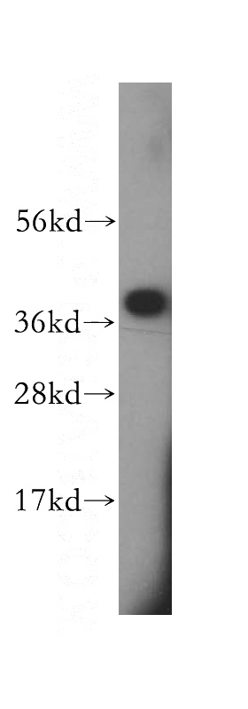 mouse brain tissue were subjected to SDS PAGE followed by western blot with Catalog No:114982(SCAMP1 antibody) at dilution of 1:1500