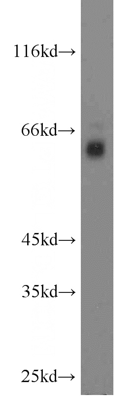 mouse brain tissue were subjected to SDS PAGE followed by western blot with Catalog No:114642(RGS14 antibody) at dilution of 1:1500