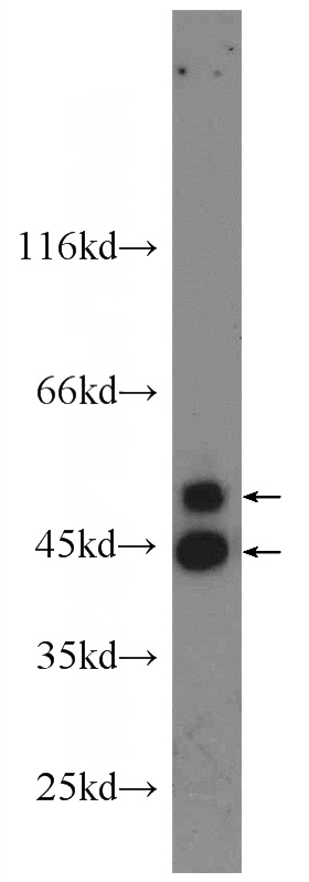 HEK-293 cells were subjected to SDS PAGE followed by western blot with Catalog No:111890(JNK antibody) at dilution of 1:1000