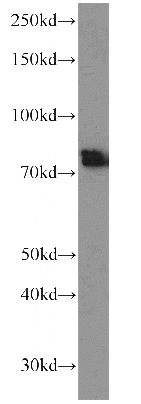 mouse brain tissue were subjected to SDS PAGE followed by western blot with Catalog No:108401(BACE1 antibody) at dilution of 1:500